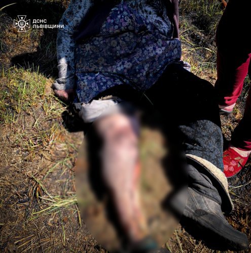У Львівській області 68-річну жінку госпіталізували з опіками внаслідок пожежі сухостою