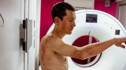 Екслідер Тур де Франс знявся з гонки після серйозного падіння