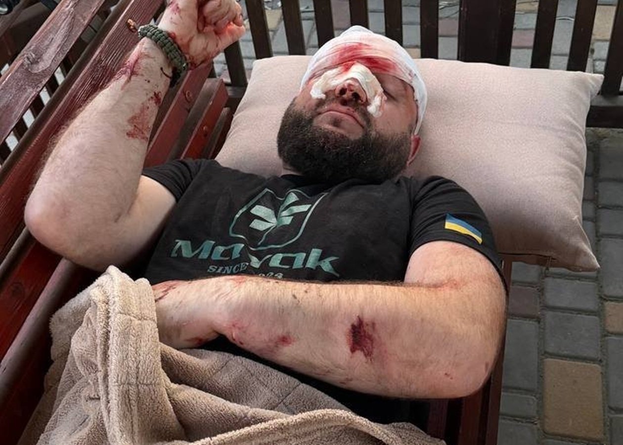 В Одеській області військового жорстоко побили через зауваження щодо російської музики