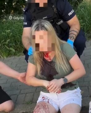 У Гдині поліція розшукує нападника, який жорстоко побив українку палицею