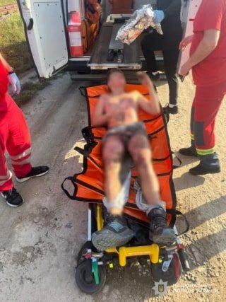 У Львові підлітка госпіталізували в реанімацію після нещасного випадку під час селфі на потязі